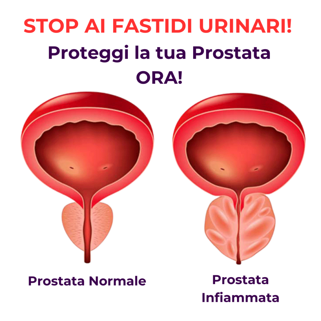 prostatite